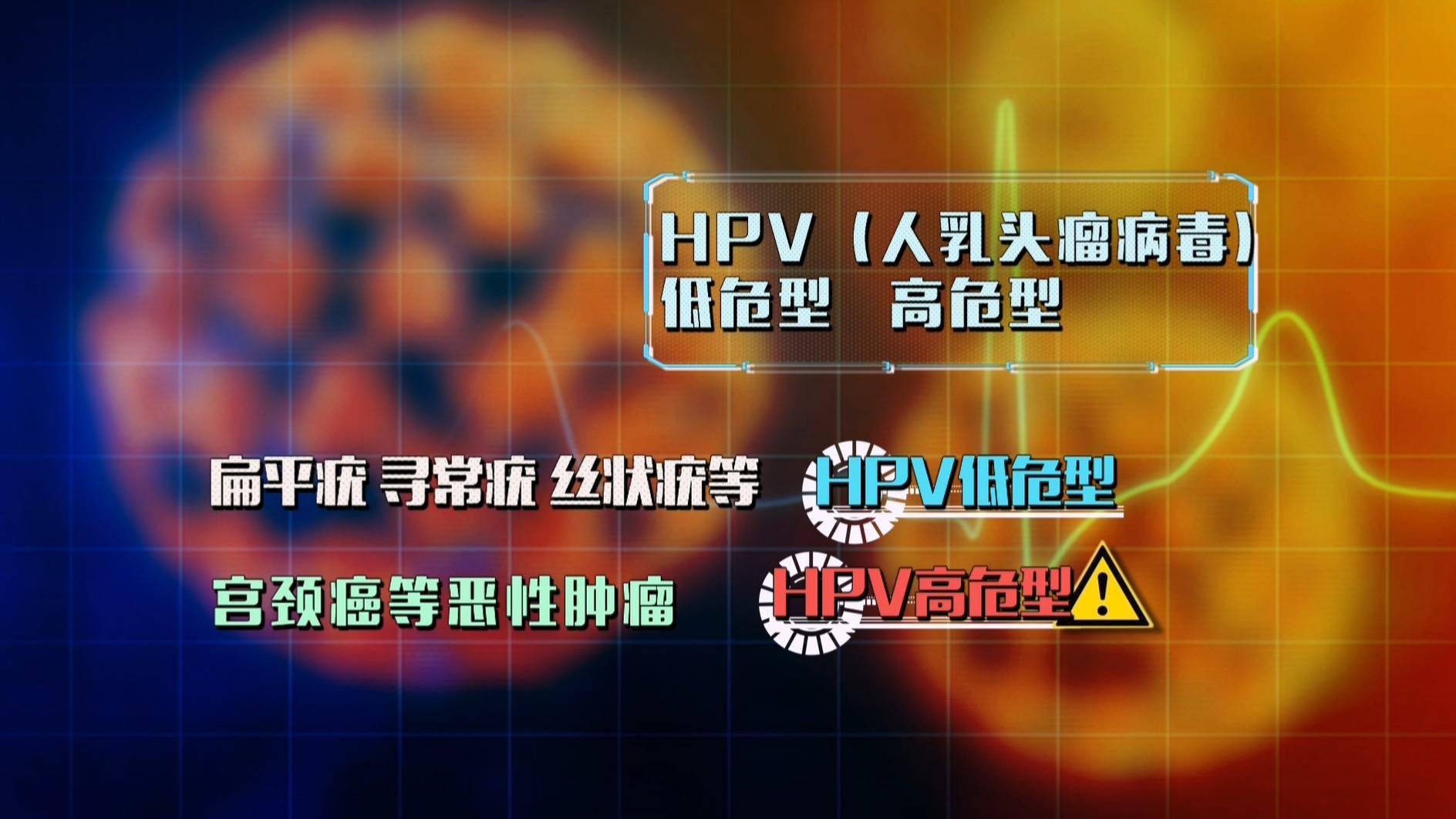 北京大學第一醫院婦科主任醫師 畢蕙:人乳頭瘤病毒大概有200種左右的