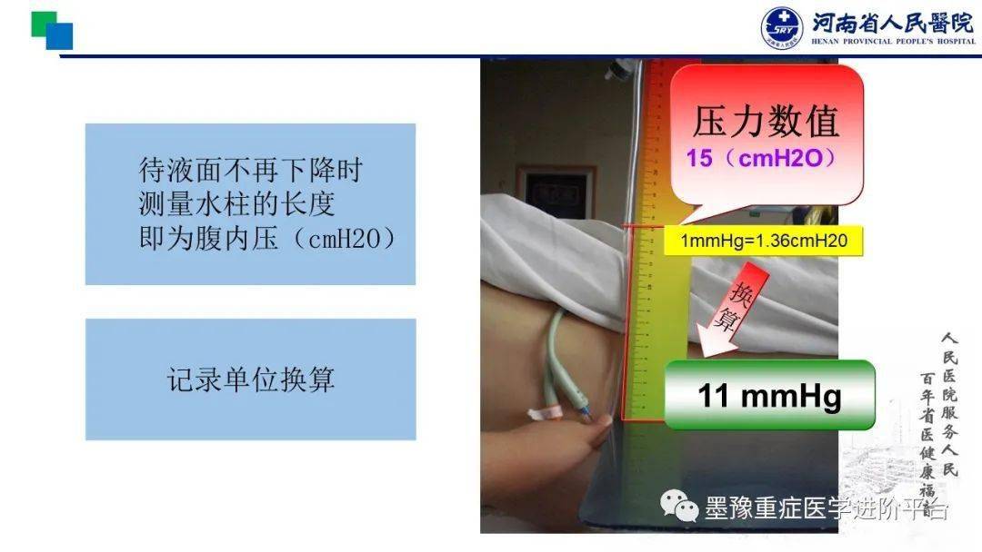 【ppt】这个"金标准"你掌握了吗?——膀胱压测定