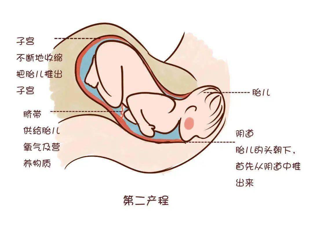 顺产全过程图解图片