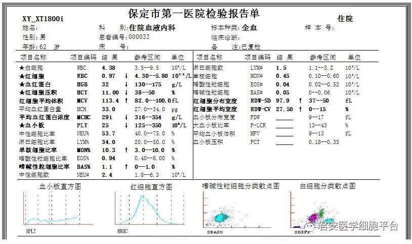 一例骨髓增生綜合徵mds伴多系血細胞發育異常mdsmld病例分享