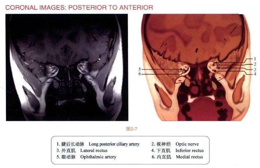 眼眶mri斷層解剖速查圖譜眼科基礎解剖精選圖集