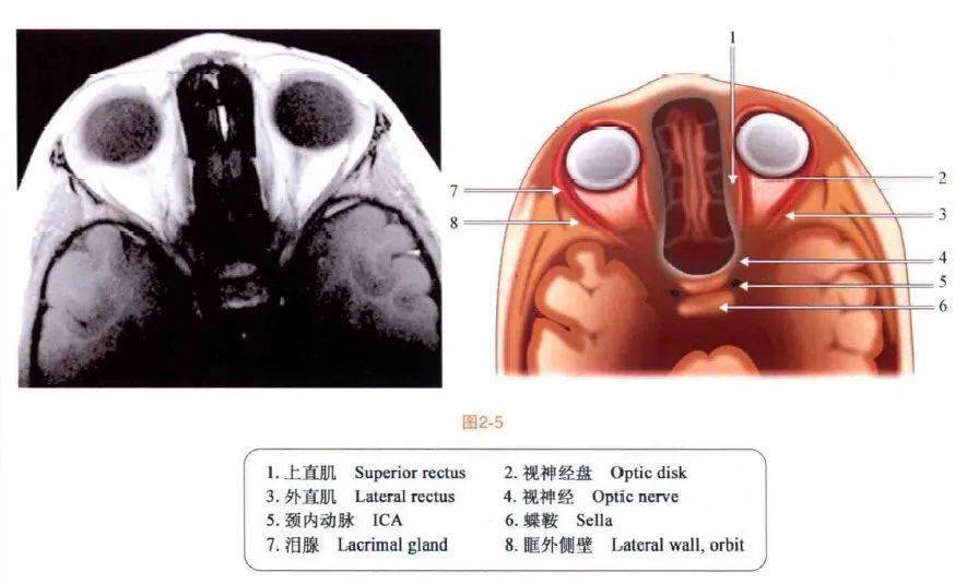 眼眶mri斷層解剖速查圖譜||眼科基礎解剖精選圖集_眼球