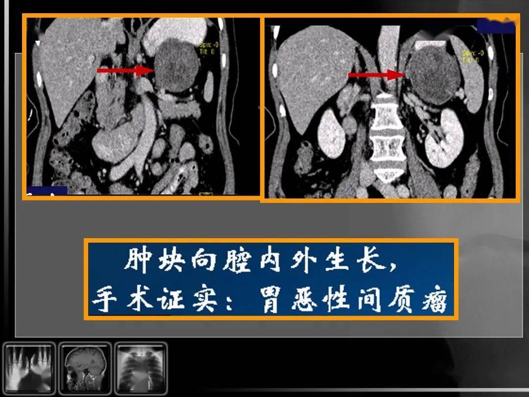 牛角胃图片