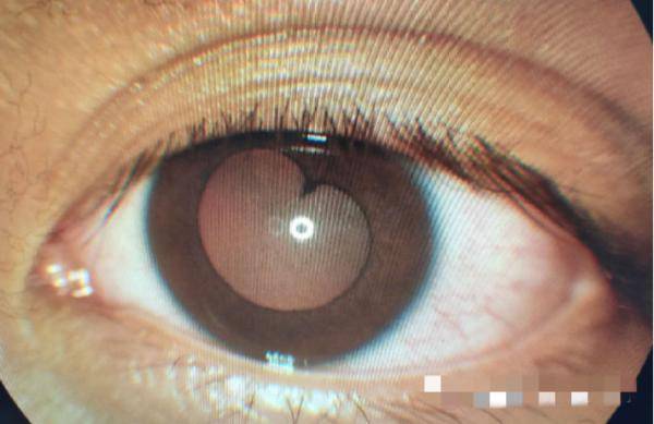 是浪漫的符号?是爱情的象征?那心形眼,梅花眼呢?