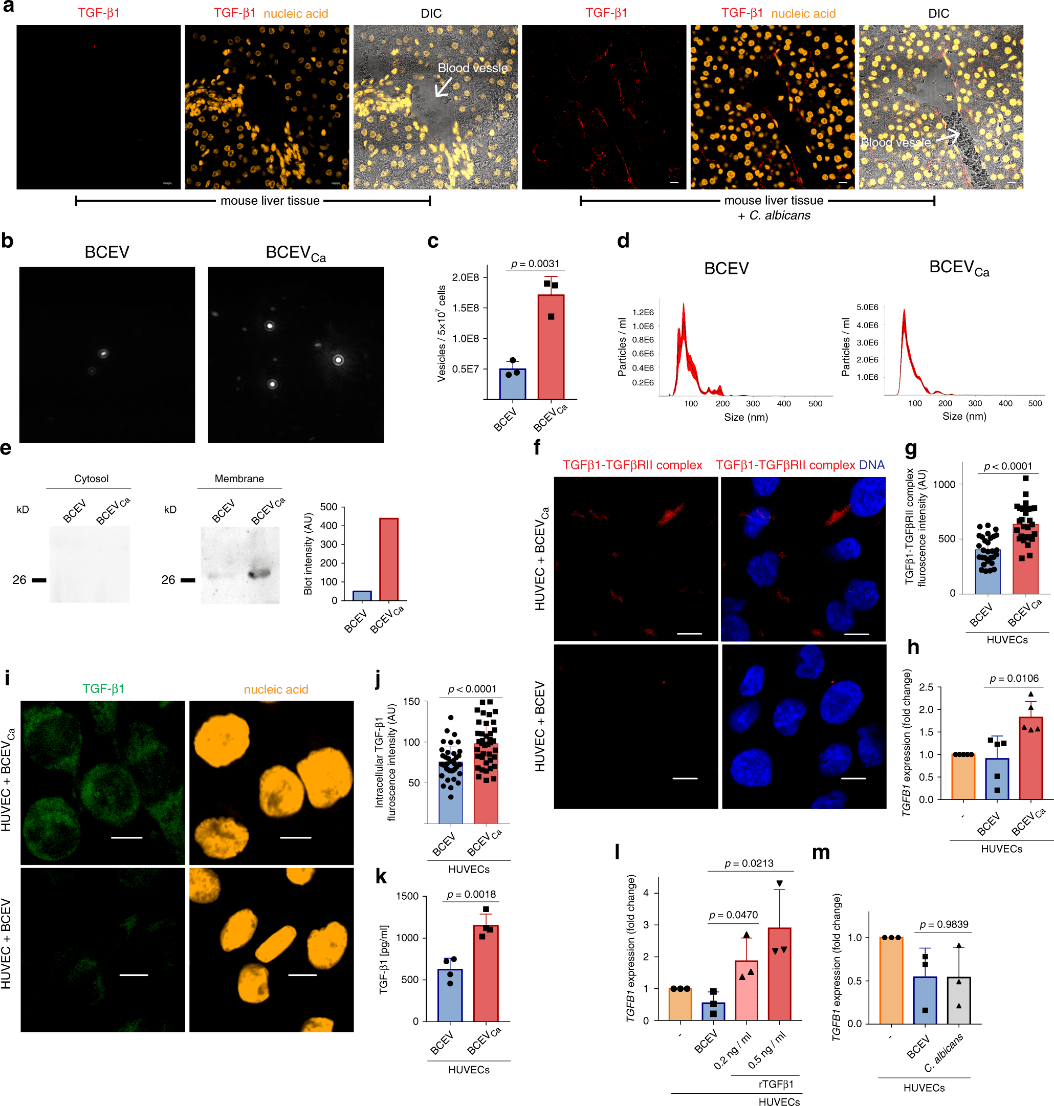 用户文章natcomm外泌体tgfβ1对白念珠菌免疫应答