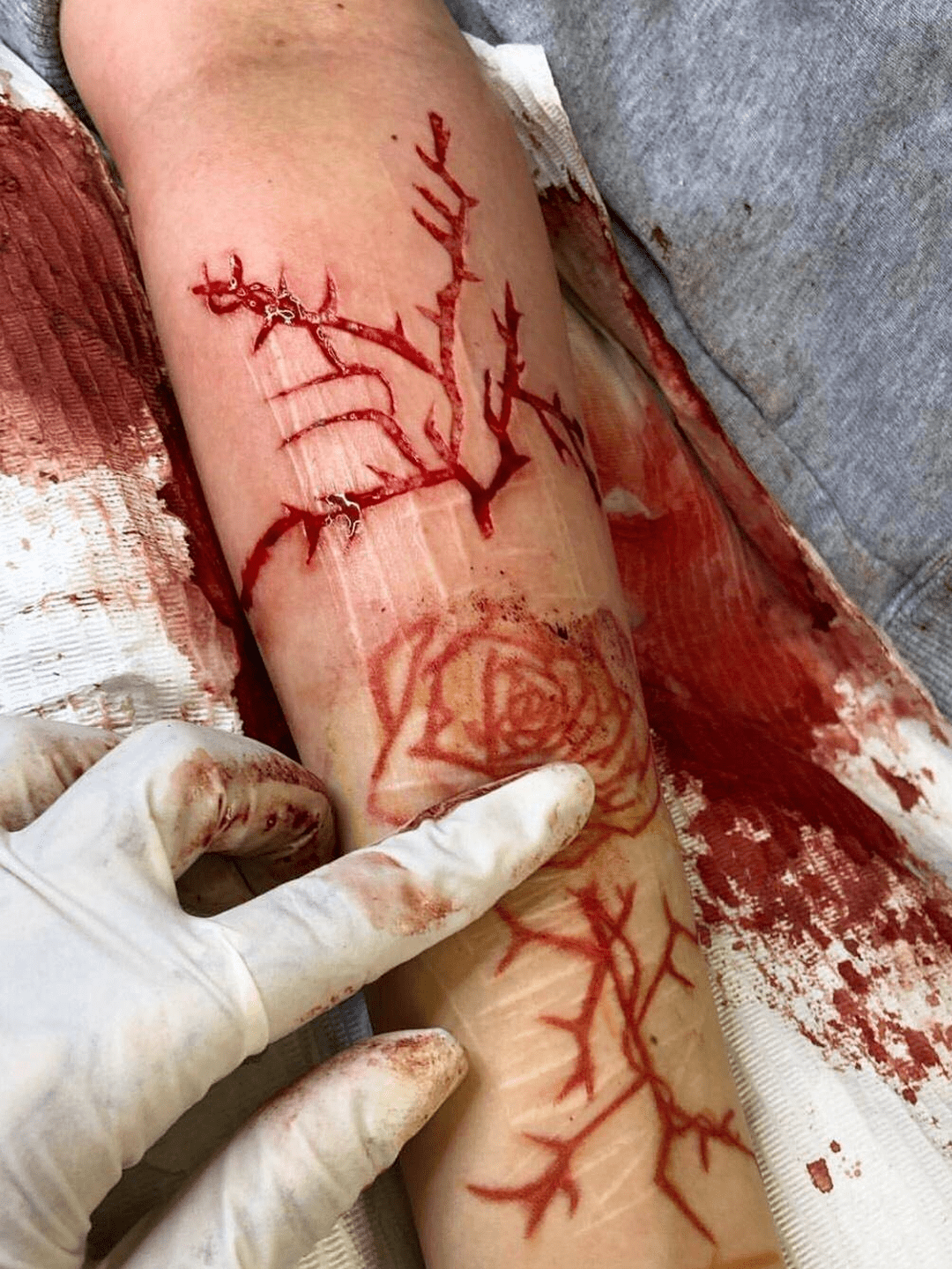 割皮纹身师小爱告诉我女孩们用剥离皮肤的方式掩盖过去的伤痕