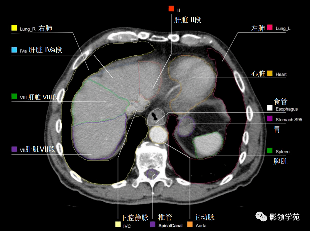 腹部影像学解剖图谱,拿走不谢!