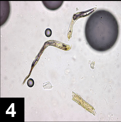 如何在腹泻病例的粪检中正确鉴定寄生虫?