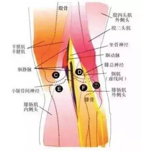 膝窝的准确位置图片图片