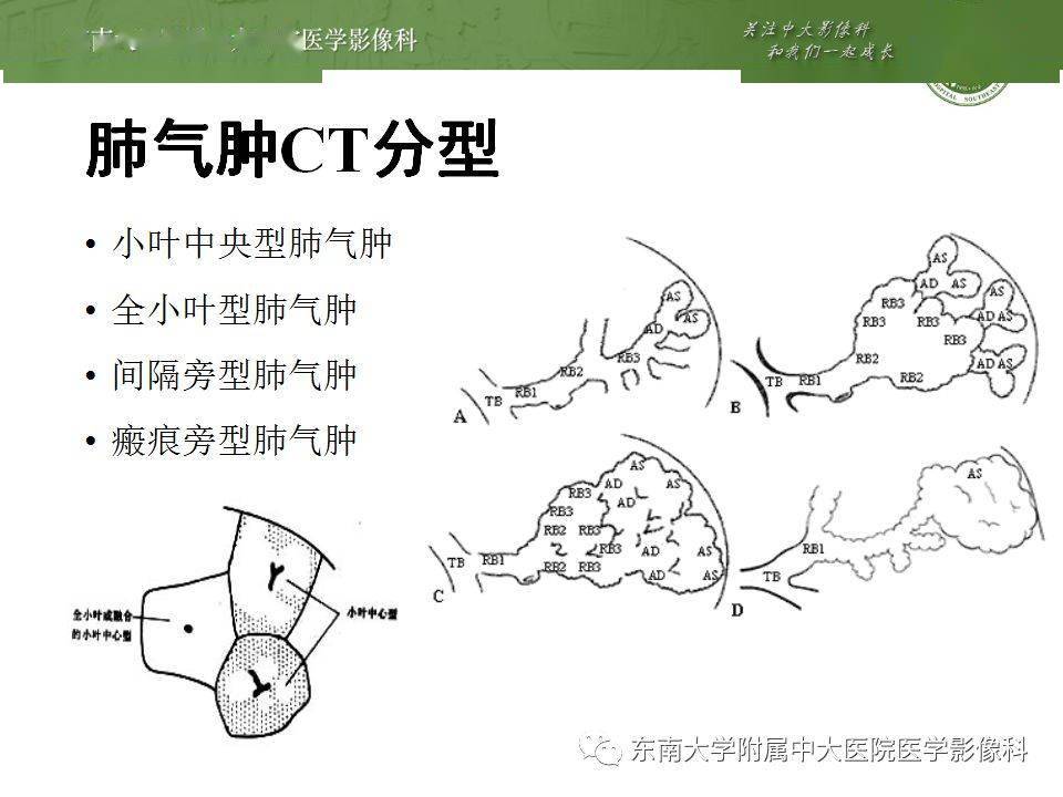 胸部丨肺气肿的ct诊断及相关鉴别诊断_手机搜狐网