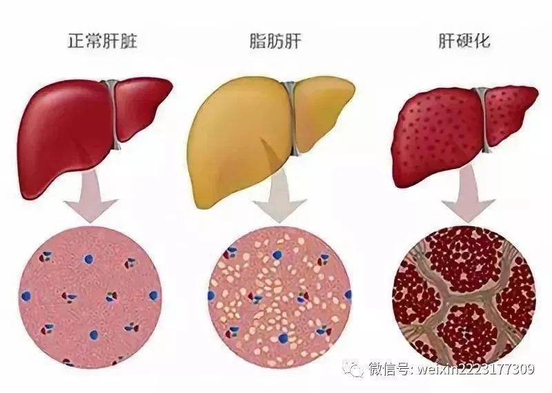 肝脏有10大功能和作用保护肝脏我们义不容辞