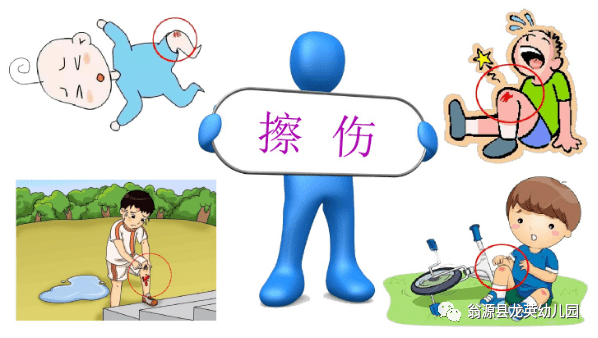 园所安全强化急救知识呵护幼儿成长翁源县龙英幼儿园意外伤害急救演练