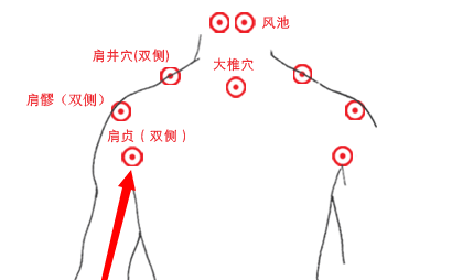 颈椎病,肩周炎,落枕,按按手臂上一条线,全解决!