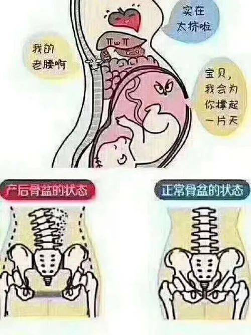 生娃後變胖胯骨變寬骨盆沒聚合才是根本原因