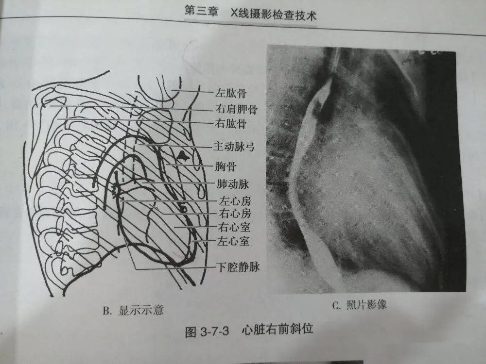 右前斜位摄影图片图片