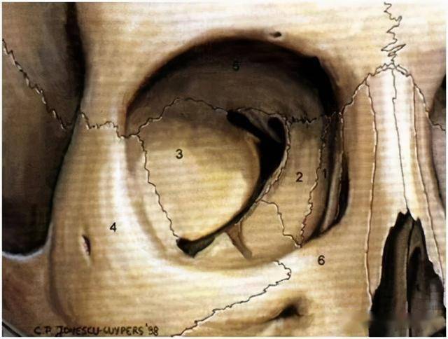 正常人的眶外侧壁的是由颧骨眶面(4)与蝶骨大翼眶面(3,14)组成