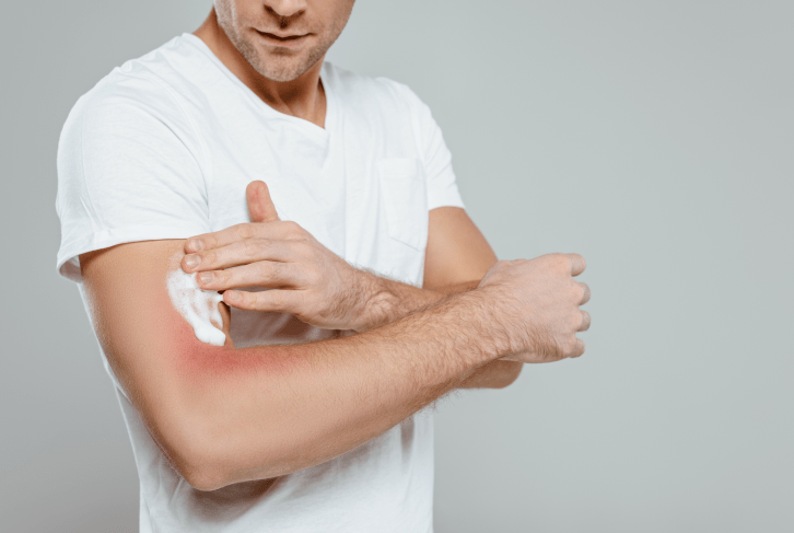 冬季皮肤瘙痒难忍5个方法助糖友摆脱困境