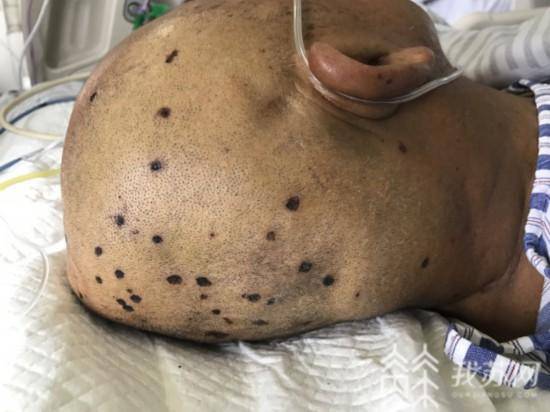 江苏已有2人丧命!野外活动谨防"蜂"出没