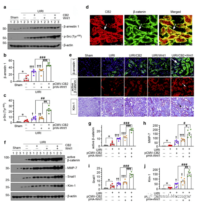kidneyint2型大麻素受体通过调控βcatenin通路促进肾脏纤维化