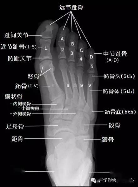 足部解剖x线图片