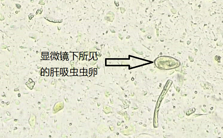 肝片吸虫结构图图片