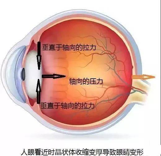 眼睛(正視眼或遠視眼)看近時的調節是睫狀肌作用在晶狀體,而這股作用