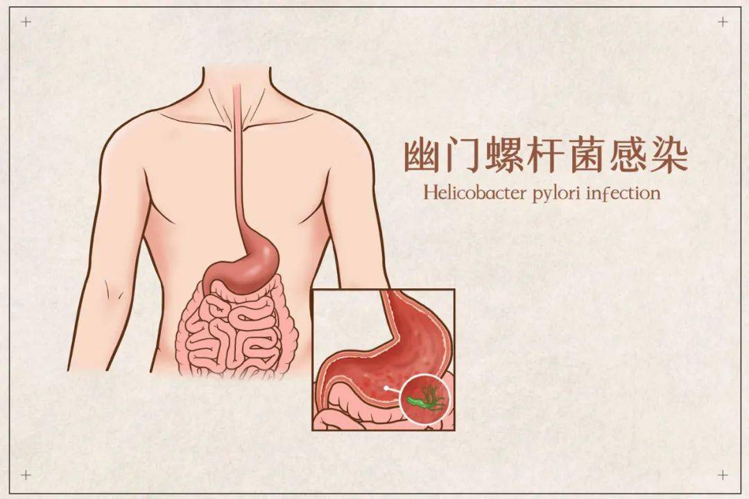 丰台疾控提醒您使用公勺公筷预防幽门螺旋杆菌感染