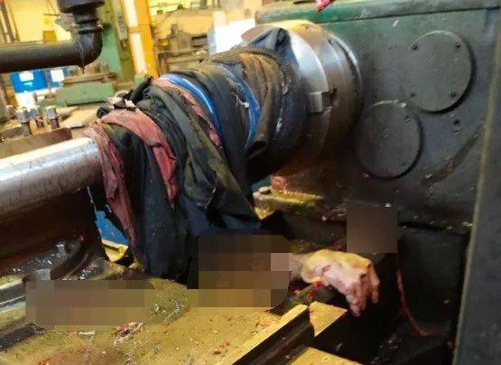 工厂安全事故血腥图片图片