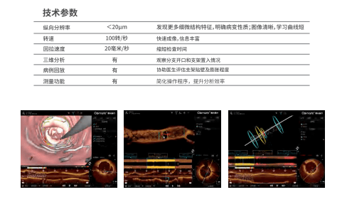 简称oct,它是当前分辨率最高的血管腔内影像学技术,成像速度快,可以