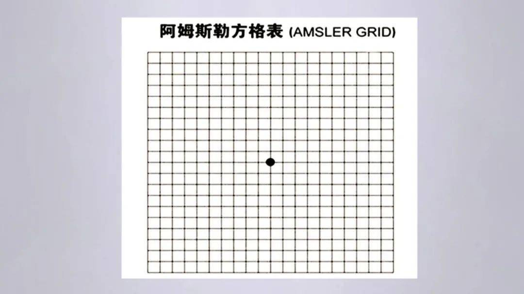 阿姆斯勒表格图片图片