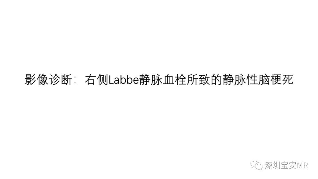 影像病例学习labbe静脉血栓形成