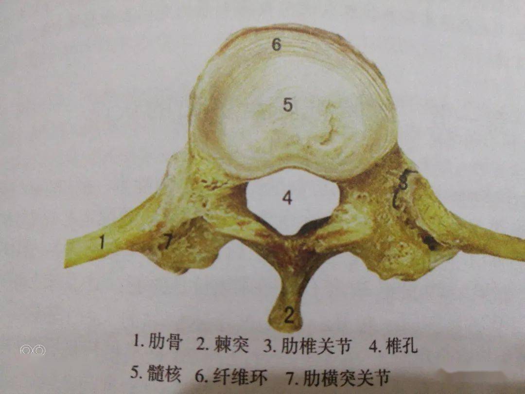 謝氏拔罐:腰間盤突出病症的相關概念_腰椎間盤