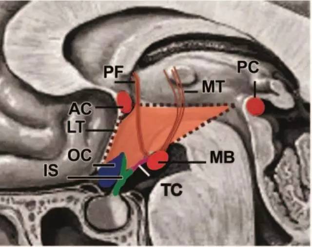 a:弓狀核;ac:前聯合;dm:背內側核;l:外側核;lpo:視前外側核;mb:乳頭體
