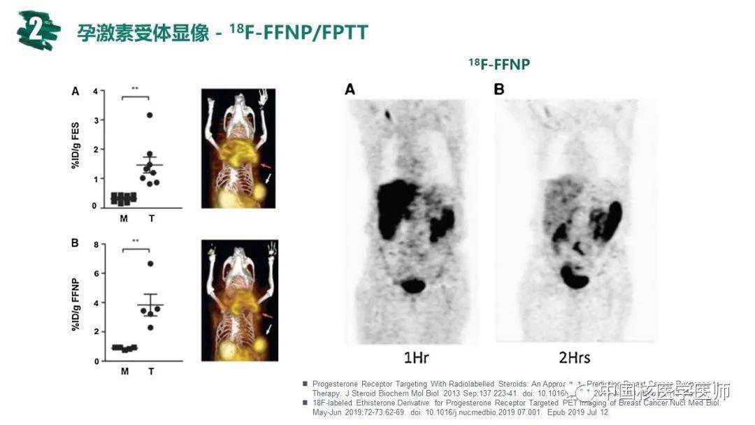 核匯園41期範巖乳腺癌petct應用進展