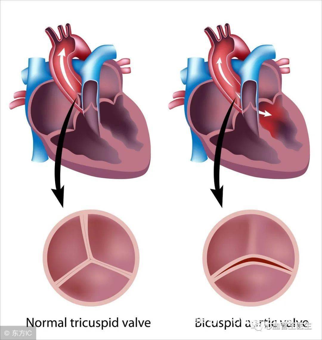 听说心脏病都要终生服药是真的吗心血管王医生给出答案
