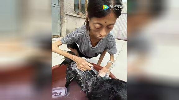 得了肌肉萎缩症的女孩体重只有25公斤看的好吓人