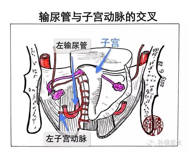 输尿管盆段位置图图片
