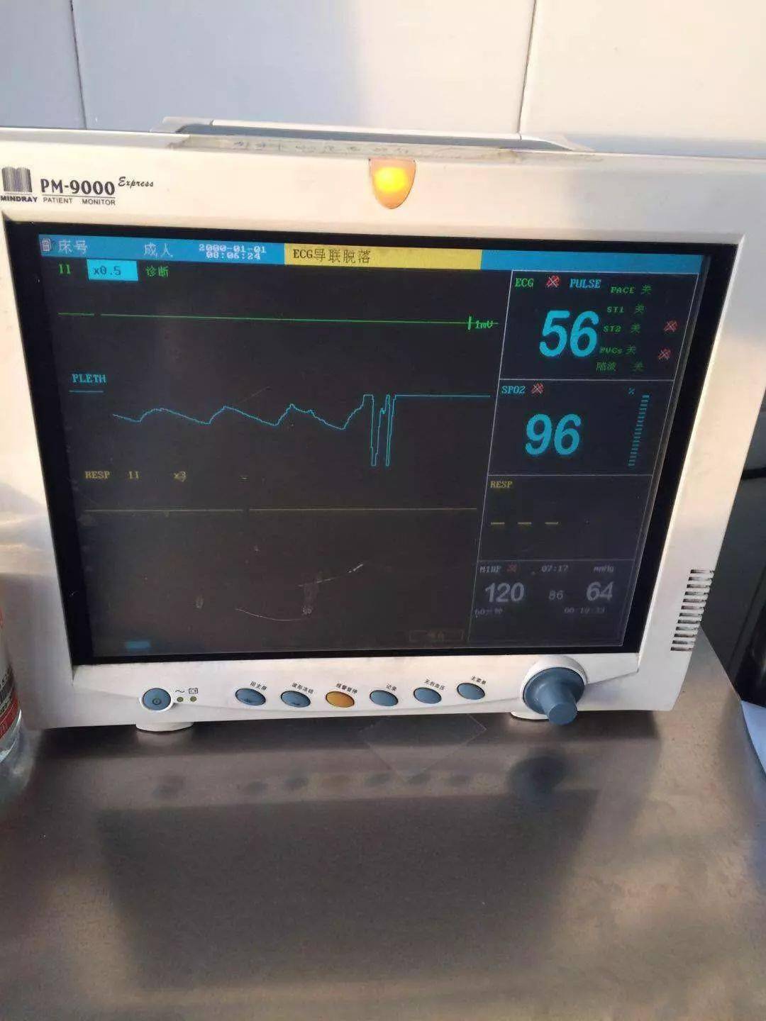 心电监护仪定位图片
