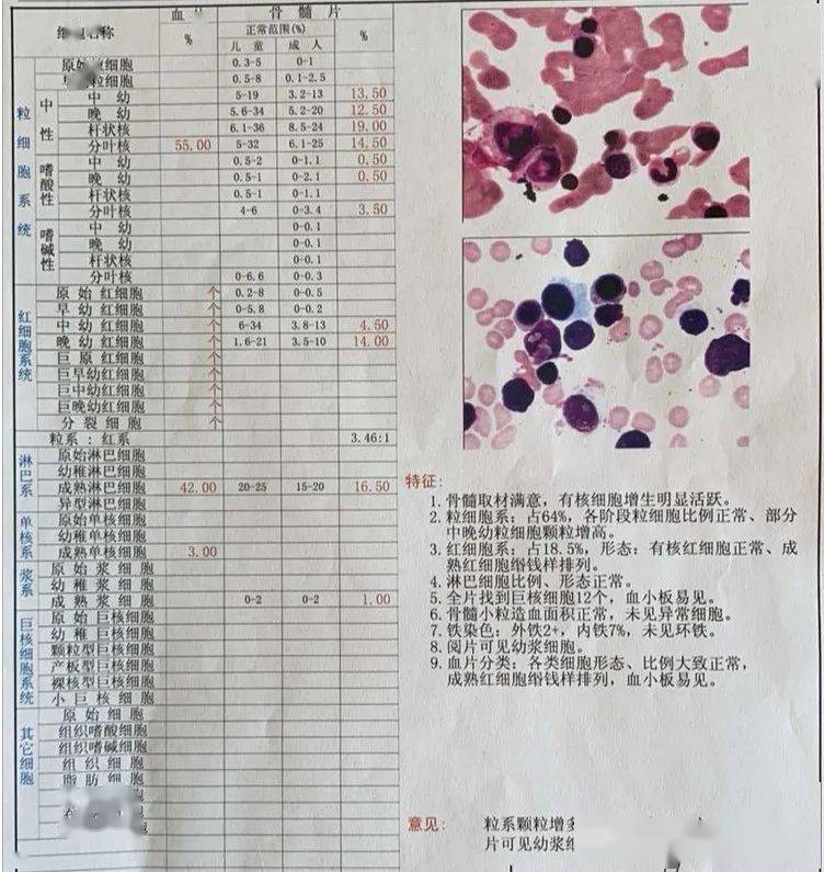 骨髓檢查報告骨髓活檢檢查報告流式細胞檢測報告病理檢測報告注:後經