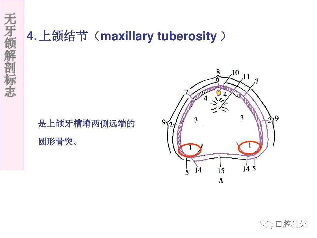 无牙颌的解剖标志图片图片