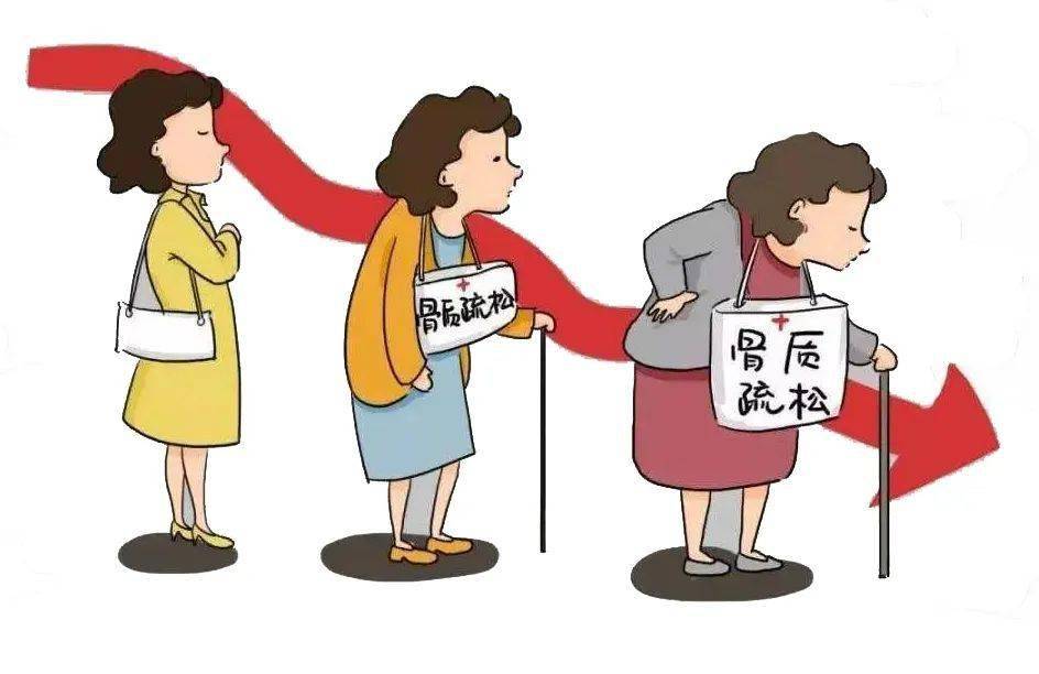 女人缺鈣衰老加快更年期補鈣你真的做對了嗎