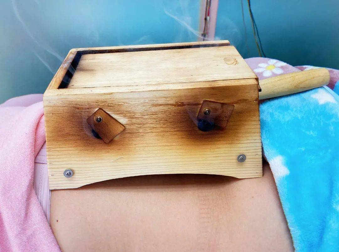 ③ 艾条灸 / 盒灸隔物灸, 是指施灸时, 将艾炷或艾条放置在姜片(隔姜