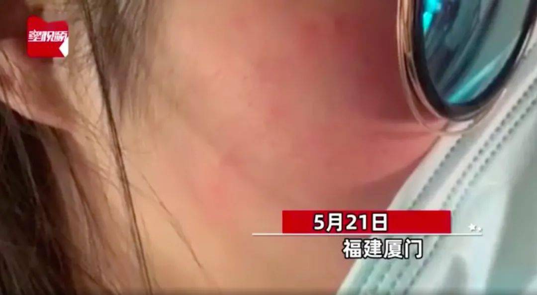 脸上长脚气健身长乳房你在第几条找到了自己的影子