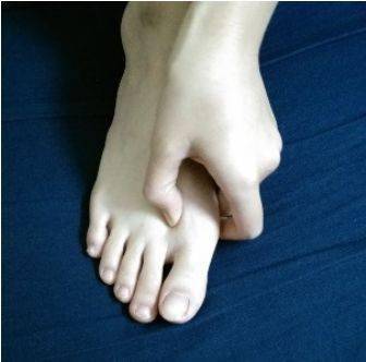 拇指外翻竟然与坐姿有关?_膝盖