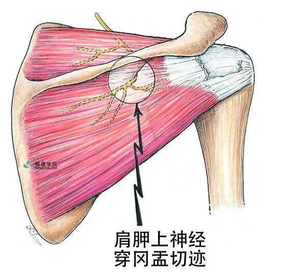 肩胛上神经继而穿过第二个切迹—冈盂切迹,冈盂切迹的顶部是下肩胛