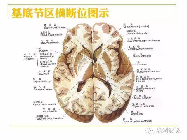 值得收藏高清頭顱mr解剖圖譜