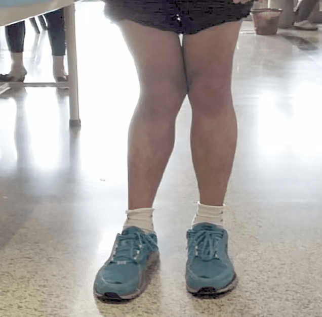 孩子走路内八or外八可能和这3个小习惯有关