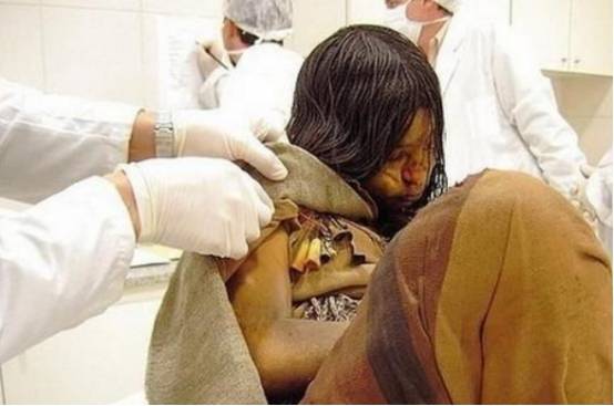 雪山现500年的少女尸骸,宛如"睡美人",专家:有毒继续冷藏