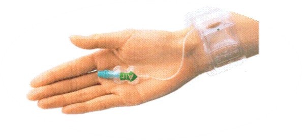 如采用大腿股动脉穿刺,护士会为您用沙袋进行局部压迫4~6小时.