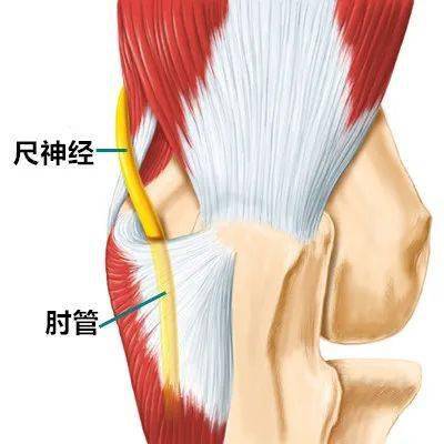 明显的体征是尺侧腕屈肌软弱或轻瘫,特别是拇指外展瘫痪,这是由拇外展